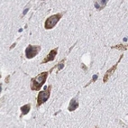 Immunohistochemical staining of human cerebral cortex using Anti-CKAP4 antibody HPA000278.