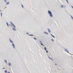 Immunohistochemical staining of human skeletal muscle using Anti-CKAP4 antibody HPA000278.