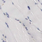Immunohistochemical staining of human skeletal muscle using Anti-CKAP4 antibody HPA000278.