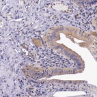 Anti-GRIPAP1 Antibody