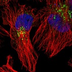 Anti-ACSL4 Antibody