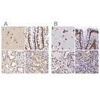 Anti-GPKOW Antibody