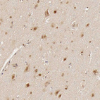 Immunohistochemical staining of human cerebral cortex shows moderate to strong nuclear positivity in neurons and i glial cells.