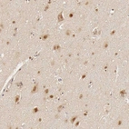 Immunohistochemical staining of human cerebral cortex shows moderate to strong nuclear positivity in neurons and i glial cells.