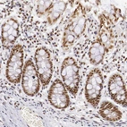 Immunohistochemical staining of human colon shows moderate to strong nuclear positivity in glandular cells.