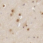 Immunohistochemical staining of human cerebral cortex using Anti-GPKOW antibody HPA000287.