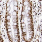 Immunohistochemical staining of human colon using Anti-GPKOW antibody HPA000287.