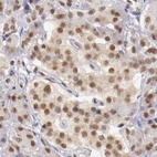 Immunohistochemical staining of human pancreas using Anti-GPKOW antibody HPA000287.