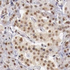 Immunohistochemical staining of human pancreas using Anti-GPKOW antibody HPA000287.