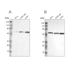 Western blot analysis using Anti-GPKOW antibody HPA000287 (A) shows similar pattern to independent antibody HPA001894 (B).