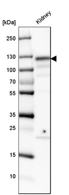 Western blot analysis in human kidney tissue.