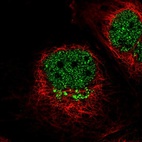 Immunofluorescent staining of human cell line A-431 shows localization to nucleoplasm & the Golgi apparatus.