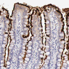 Immunohistochemical staining of human small intestine shows strong membranous positivity in glandular cells.