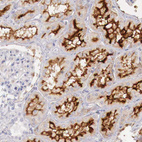 Immunohistochemical staining of human kidney shows strong membranous positivity in cells in tubules.