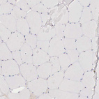 Immunohistochemical staining of human skeletal muscle shows no positivity in myocytes as expected.