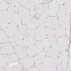 Immunohistochemical staining of human skeletal muscle shows no positivity in myocytes as expected.