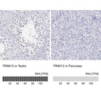 Anti-TRIM13 Antibody