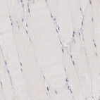 Immunohistochemical staining of human skeletal muscle shows shows no positivity in myocytes as expected.