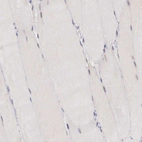 Immunohistochemical staining of human skeletal muscle shows shows no positivity in myocytes as expected.