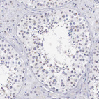 Immunohistochemical staining of human testis shows moderate dot-like cytoplasmic positivity in cells in seminiferous ducts.