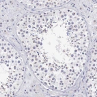 Immunohistochemical staining of human testis shows moderate dot-like cytoplasmic positivity in cells in seminiferous ducts.