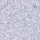Immunohistochemical staining of human pancreas shows no positivity in exocrine glandular cells as expected.