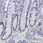Immunohistochemical staining of human rectum shows moderate nuclear positivity in glandular cells.