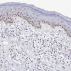 Immunohistochemical staining of human skin shows moderate nuclear positivity in deep epidermal cells.
