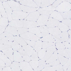 Immunohistochemical staining of human skeletal muscle shows no positivity in striated muscle fibers as expected.