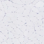 Immunohistochemical staining of human skeletal muscle shows no positivity in striated muscle fibers as expected.