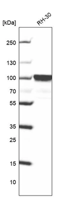 Western blot analysis in human cell line RH-30.