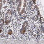 Anti-CTAGE5 Antibody