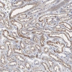 Immunohistochemical staining of human kidney shows weak granular positivity in cytoplasm in cells in tubules.