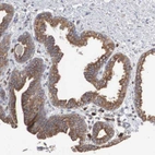 Immunohistochemical staining of human prostate shows moderate granular positivity in cytoplasm in glandular cells.