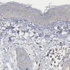 Immunohistochemical staining of human skin shows low positivity in squamous epithelial cells as expected.
