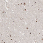 Anti-AUTS2 Antibody