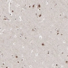 Anti-AUTS2 Antibody