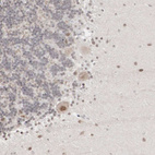 Immunohistochemical staining of human Cerebellum shows moderate nuclear positivity in Purkinje cells.