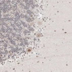 Immunohistochemical staining of human Cerebellum shows moderate nuclear positivity in Purkinje cells.