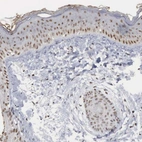 Immunohistochemical staining of human Skin shows moderate nuclear positivity in keratinocytes.