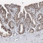 Immunohistochemical staining of human prostate shows weak to moderate nuclear positivity in glandular cells.