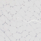 Immunohistochemical staining of human skeletal muscle shows very weak nuclear positivity in myocytes.