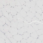 Immunohistochemical staining of human skeletal muscle shows very weak nuclear positivity in myocytes.