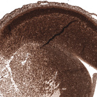 Immunohistochemical staining of mouse embryo (E14) cortical plate shows strong nuclear positivity in neuronal cells.