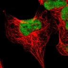 Immunofluorescent staining of human cell line A-431 shows localization to nucleoplasm.