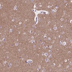 Immunohistochemical staining of human cerebral cortex shows high expression.