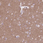 Anti-SYN1 Antibody