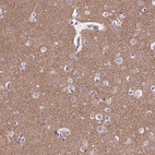 Immunohistochemical staining of human cerebral cortex shows high expression.