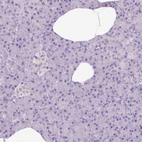 Immunohistochemical staining of human pancreas shows low expression as expected.