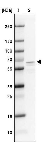 Lane 1: Marker [kDa] 250, 130, 100, 70, 55, 35, 25, 15, 10_br/_Lane 2: Human Cerebral Cortex tissue
